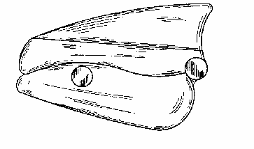 Figure on page 2 of the opinion