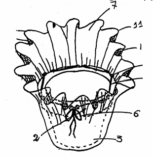 Figure on page 11 of the opinion