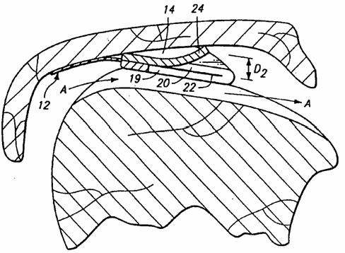 Figure on page 11 of the opinion