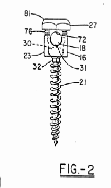 Figure on page 4 of the opinion