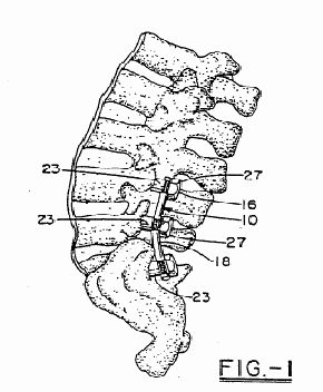 Figure on page 4 of the opinion