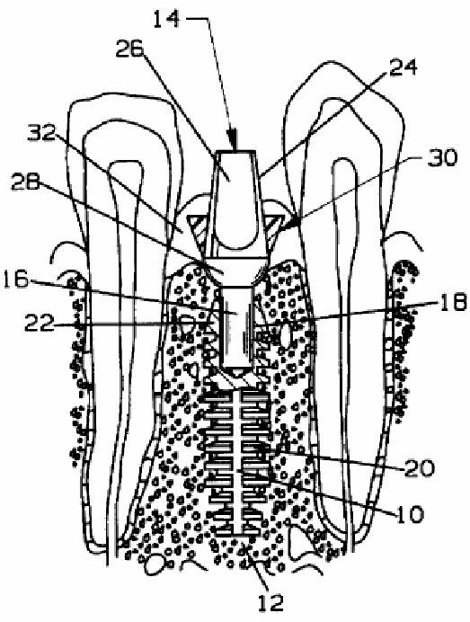 Figure on page 4 of the opinion