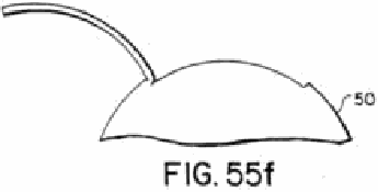 Figure on page 3 of the opinion