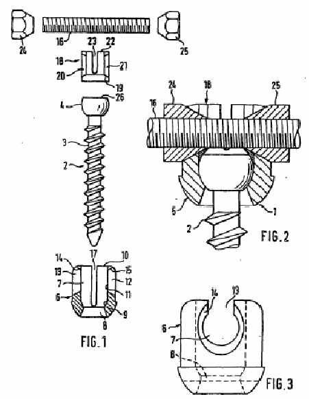 Figure on page 5 of the opinion