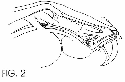 Figure on page 4 of the opinion