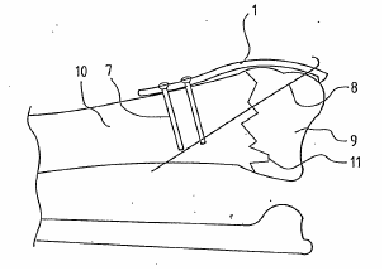 Figure on page 3 of the opinion