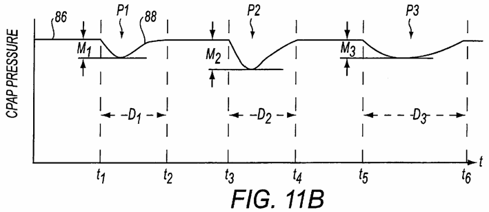 Figure on page 12 of the opinion