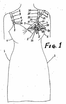 Figure on page 15 of the opinion