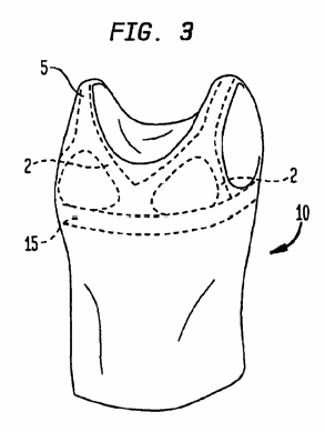 Figure on page 3 of the opinion