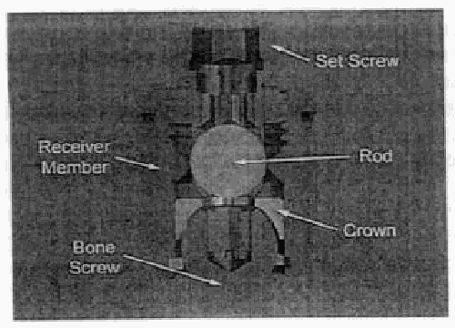 Figure on page 15 of the opinion