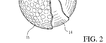 Figure on page 4 of the opinion
