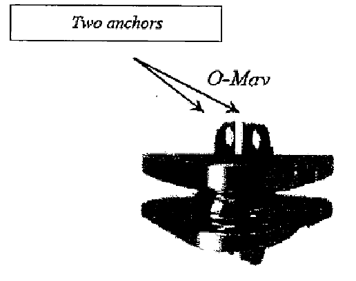 Figure on page 18 of the opinion