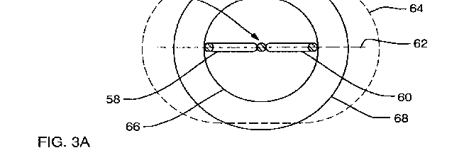 Figure on page 17 of the opinion